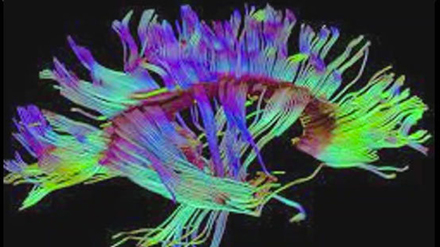Les neurosciences au service de la psychiatrie