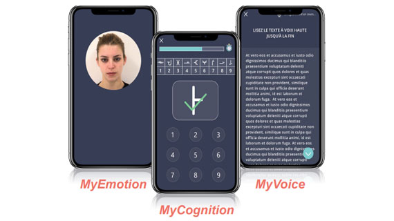 Évaluation d’un module digital prédictif de la résistance aux antidépresseurs  