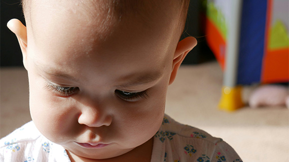 Diagnostic précoce en imagerie d'un trouble du spectre autistique chez un enfant