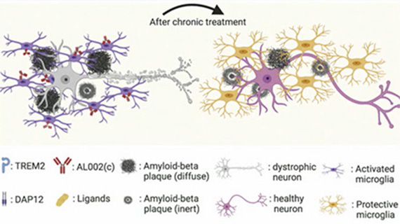 L'Alzheimer en 2024
