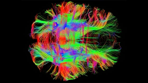 Neurodéveloppement et imagerie cérébrale : comprendre le TSA, le TDAH et les troubles du développement
