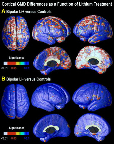 Lithium-et-cerveau-des-pistes-de-recherches-figure2
